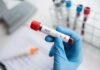 Lawmakers Target Decades-Old Public Health Restrictions Gloved hand holding a blood sample tube labeled for HIV test