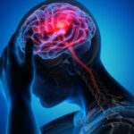 X-ray illustration of a person with a headache.