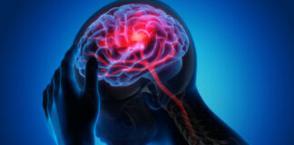 X-ray illustration of a person with a headache.