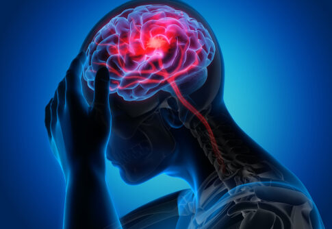 X-ray illustration of a person with a headache.