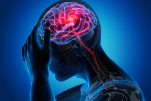 X-ray illustration of a person with a headache.