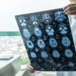 Doctor examines brain X-ray images near a window.