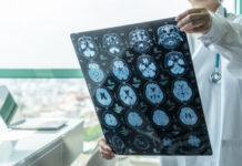 Doctor examines brain X-ray images near a window.