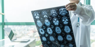 Doctor examines brain X-ray images near a window.