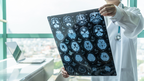 Doctor examines brain X-ray images near a window.